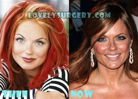 geri halliwell before and after.